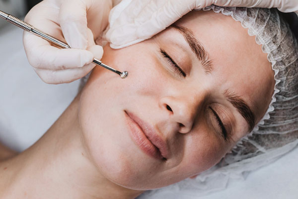 facial with extractions in Pittsburgh, PA